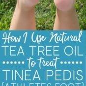 Learn how I successfully use tea tree oil to treat tinea pedis (athletes foot) instead of over-the-counter products. The fungus is gone in DAYS!